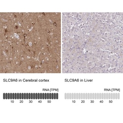 NHE6/SLC9A6 Antibody, Novus Biologicals 0.1mL; Unlabeled:Antibodies, Polyclonal